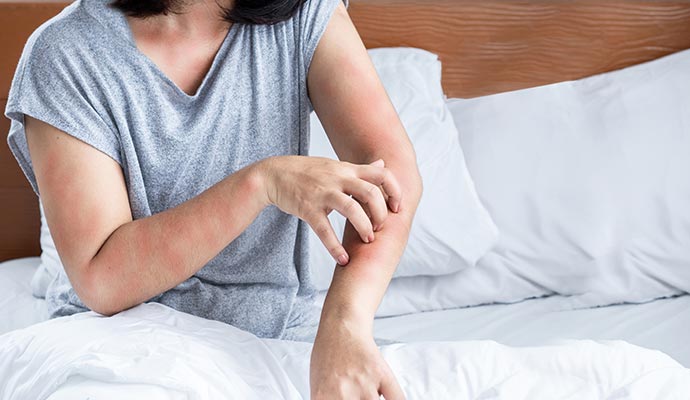 Allergic reaction skin rash treatment