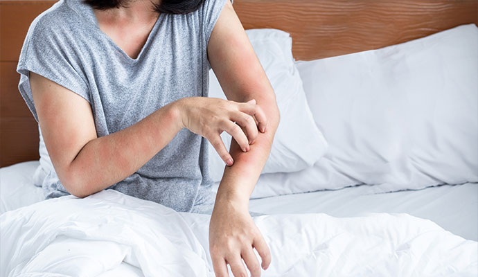 Person scratching an allergic skin reaction caused by indoor allergens